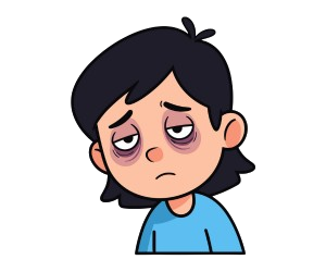 Dark Circles & puffy eyes