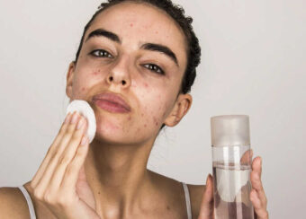 Skincare routine for Acne
