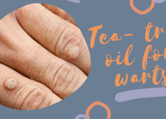 tee tree oil for warts