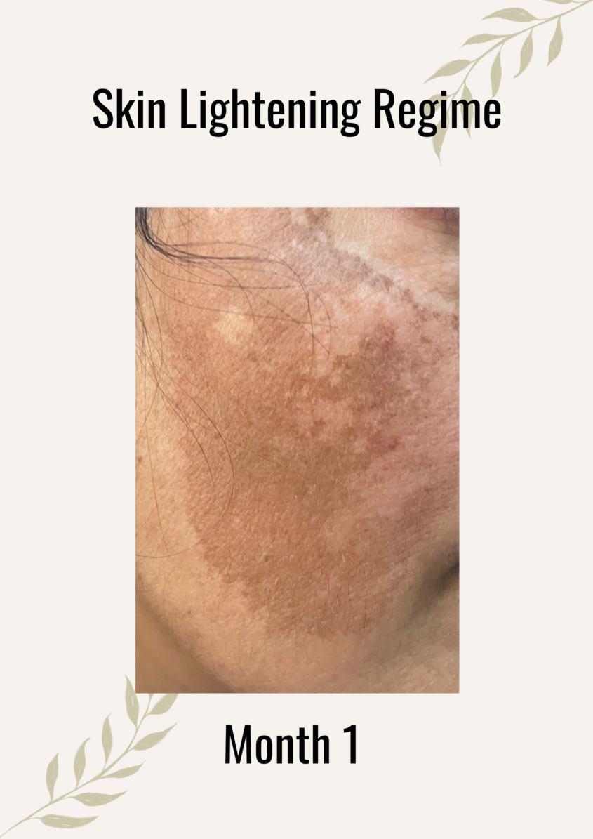 Skin Lightening regime