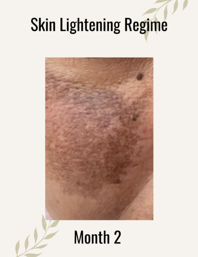 Skin-lightening-regime-month-2